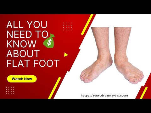 Flat Feet Explained – Dr. Gaurav Jain Pediatric Orthopedic Surgeon – click to play