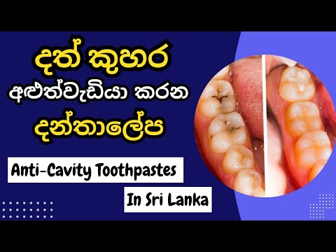 දත් කුහර ගෙදරදිම හොඳ කරන දන්තාලේපය | Best Toothpaste in Sri Lanka (සායනිකව තහවුරුයි)