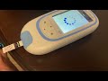 Checking My INR CoaguChek INR Monitoring