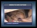 WHO Video On Giving Oxygen To Children I