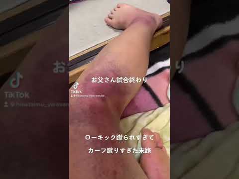 【お父さん】ローキック蹴られすぎてカーフ蹴りすぎた末路
