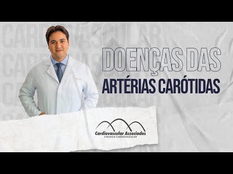 DOENÇAS DAS ARTÉRIAS CARÓTIDAS