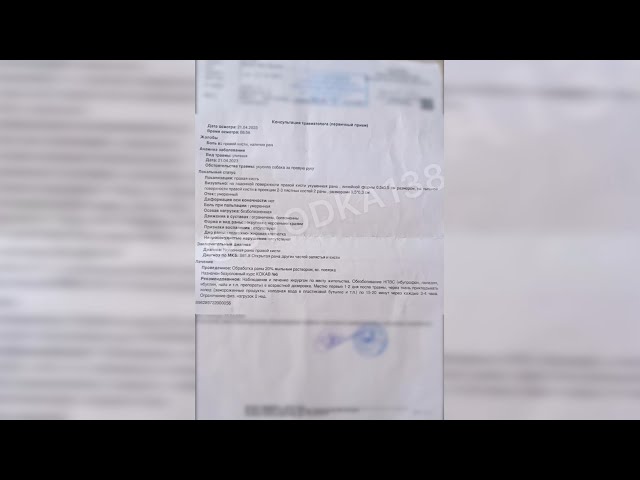 В Иркутске собаки напали на ребёнка