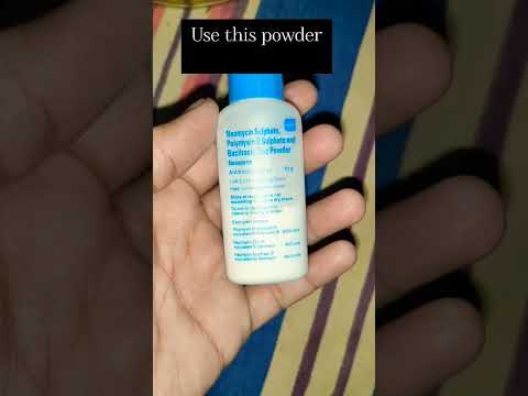 Use this powder when umbilical cord Falls #shorts