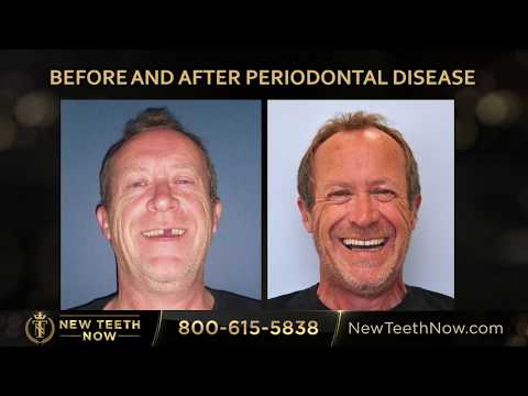 download lagu mp3 mp4 New Teeth Now, download lagu New Teeth Now gratis, unduh video klip New Teeth Now