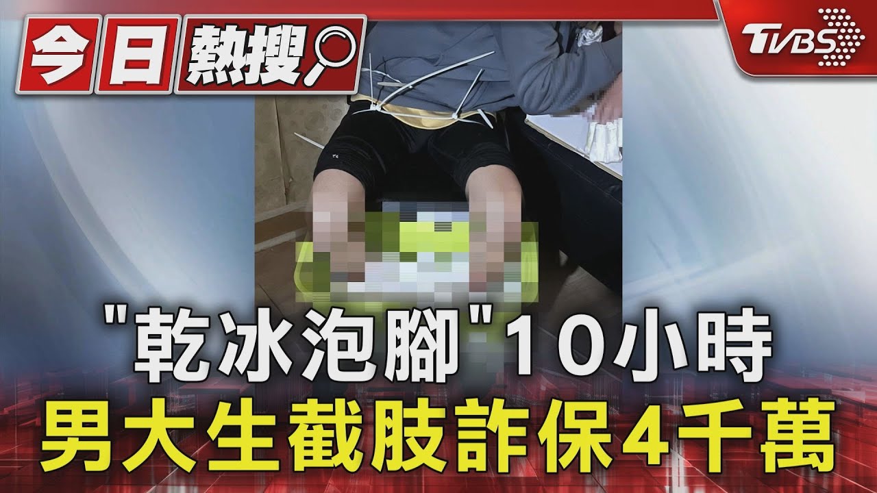 「乾冰泡腳」10小時 男大生截肢詐保4千萬