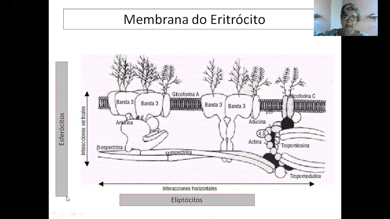 Aula Anemias Defeito de Membrana