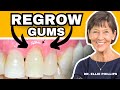 How To REGROW Receding Gums (FIX Gum Recession At Home)