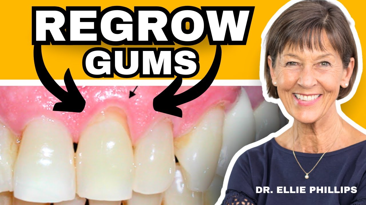 How To REGROW Receding Gums (FIX Gum Recession At Home)