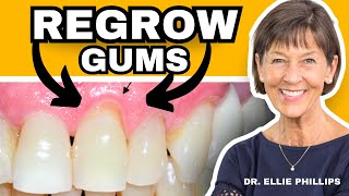 How To REGROW Receding Gums (FIX Gum Recession At Home)