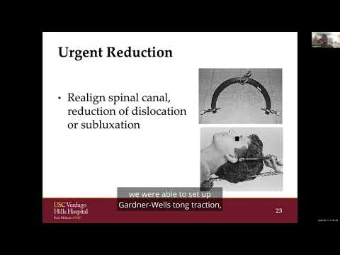 Emergent Spine Conditions: Spine Fractures