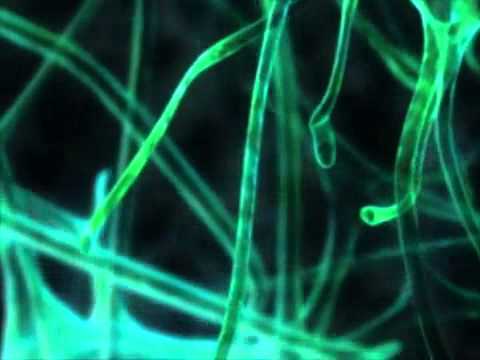 The Brain and Its Chemicals Video