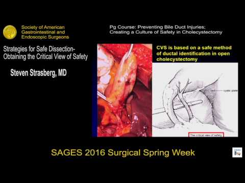 Strategies for safe dissection — Obtaining the critical view of safety (SAGES)