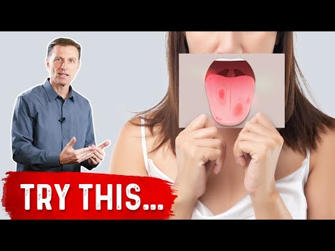 Yellow Bumpy Patches Around the Eyelids