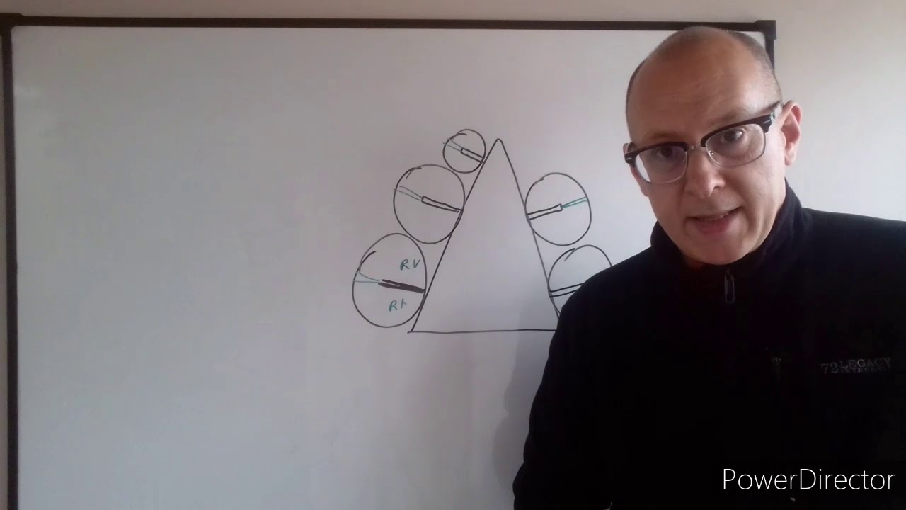 Teórico N° 63 b Oído interno  Dr  Luciano Esborrat