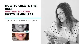 How to create the best Before and After dental case photos for your social media | New patients