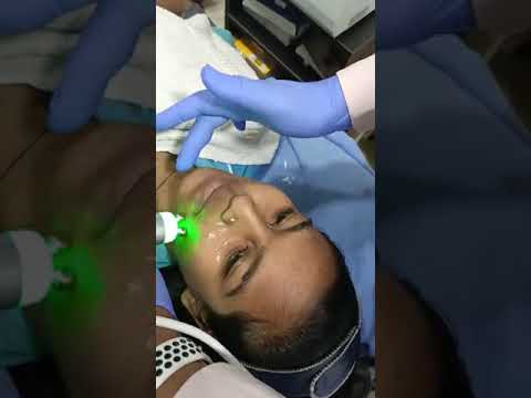 Imported Hydrafacial Machine