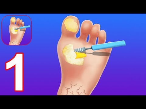 Foot Clinic - ASMR Feet Care - Gameplay Walkthrough Part 1 (Android, iOS) - YouTube