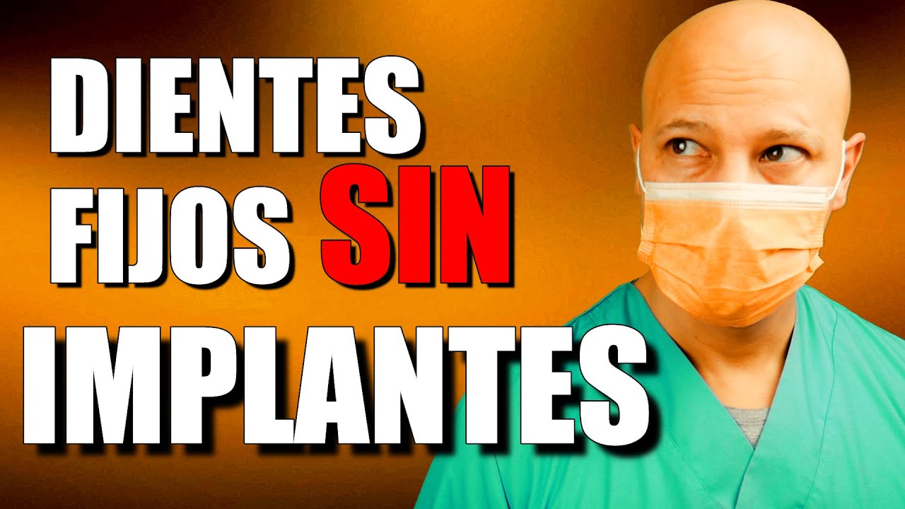 PRÓTESIS DENTAL FIJA sin IMPLANTES una ALTERNATIVA mas (esto lo debes saber)