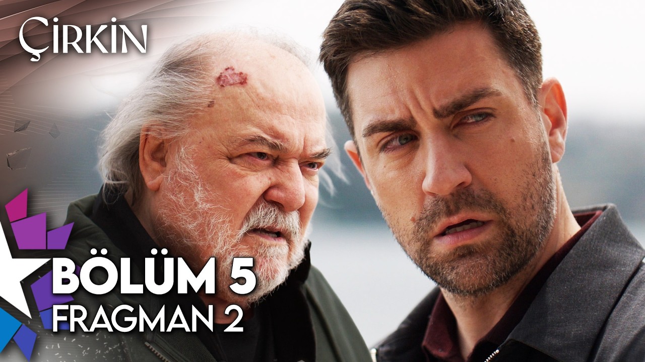 Çirkin 5. Bölüm 2. Fragmanı