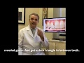 No to porcelain veneers, Fix black triangles w/o grinding your tooth away, Bioclear to the rescue!