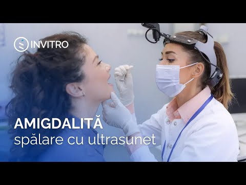 Spălarea amigdalelor infectate cu ultrasunet