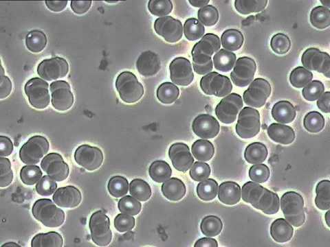 CCC0140004 @2014.01.21 before/after treatment photos