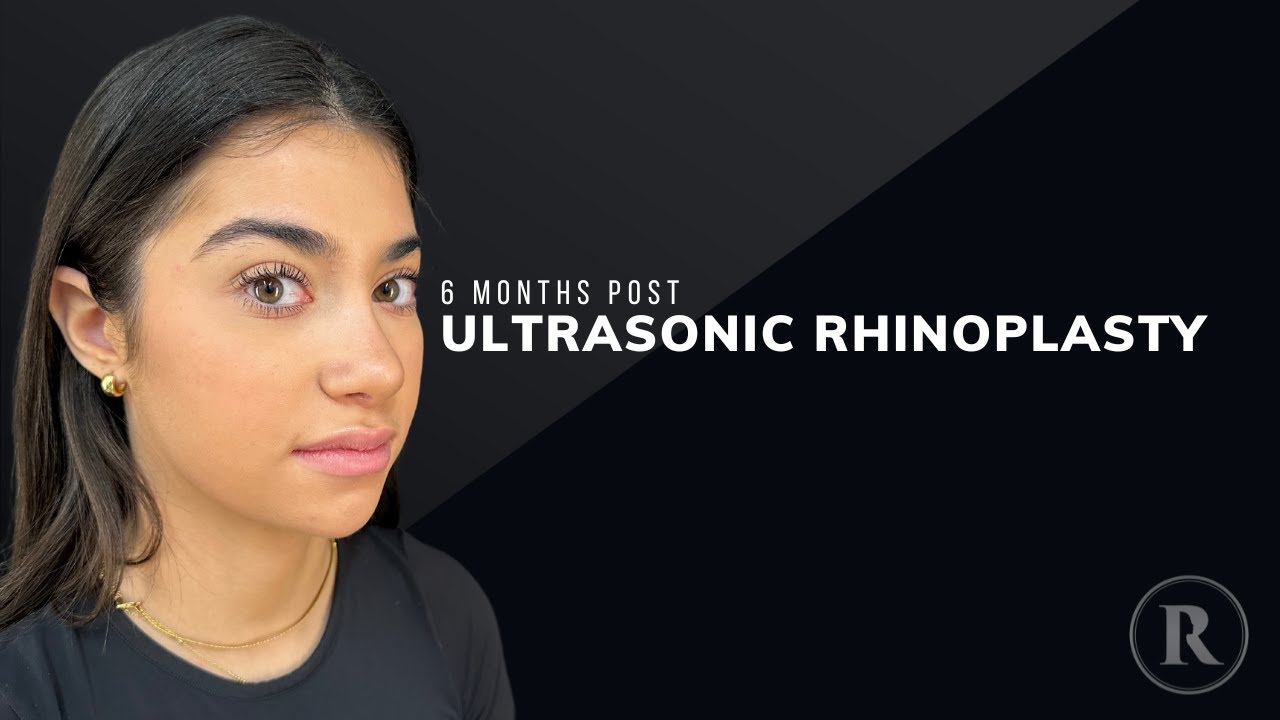 Robb Facial Plastic Surgery