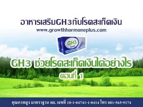 รักษาดินเหนียวสีขาวของโรคสะเก็ดเงิน ปรสิตและโรคสะเก็ดเงินเรา