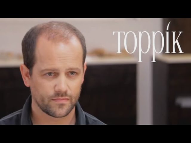 Toppik Fibres de renforcement capillaire