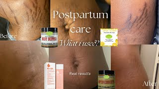 Postpartum during&aftercare/ what I used to fade my stretch marks | how I fade my stretch marks?