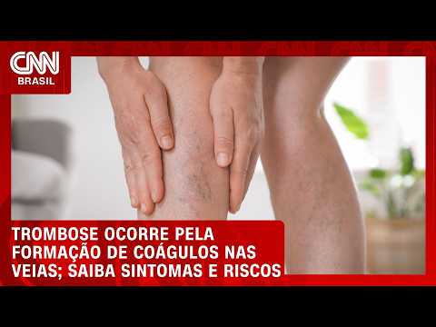 Trombose: entenda o que é, sintomas e riscos | CNN SINAIS VITAIS