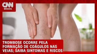 Vídeo: Trombose: entenda o que é, sintomas e riscos | CNN SINAIS VITAIS