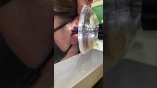 Removing Ear Wax using The Earigator™ at Hearing HealthCare Centers, Broomfield, CO