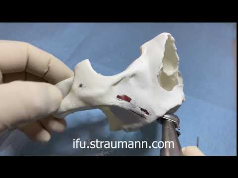 Dr. Bedrossian Zygomatic Hands on Demo