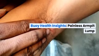 Painless Armpit Lump: Common Causes and When to Seek Medical Care | BuoyHealth.com