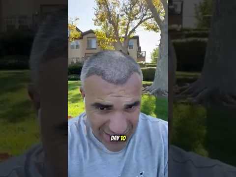 A new look, a new confidence. At TurchCare, we believe every detail matters. 🌿 #turchcare #istanbul