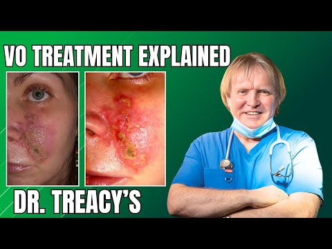 Dr Patrick Treacy explains how to treat a vascular occlusion to Dr. Tim Pearce
