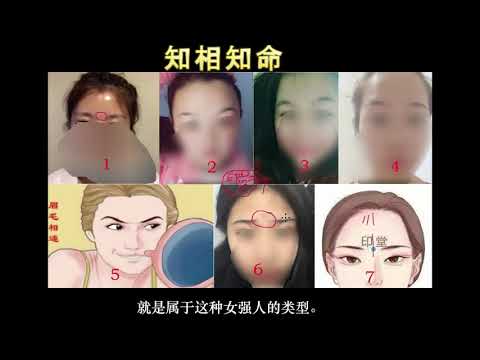 印堂凹陷女人