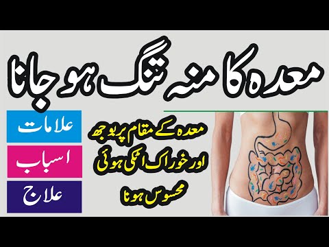 Meda Ke Muh Ka Tang Ho Jana (Alamat, Asbab & Ilaj) Stomach Problem Treatment In Urdu/Hindi.