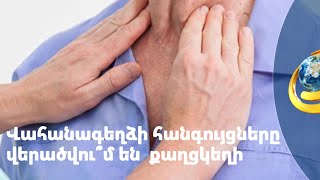 Վահանագեղձի հանգույցները վերածվու՞մ են քաղցկեղի