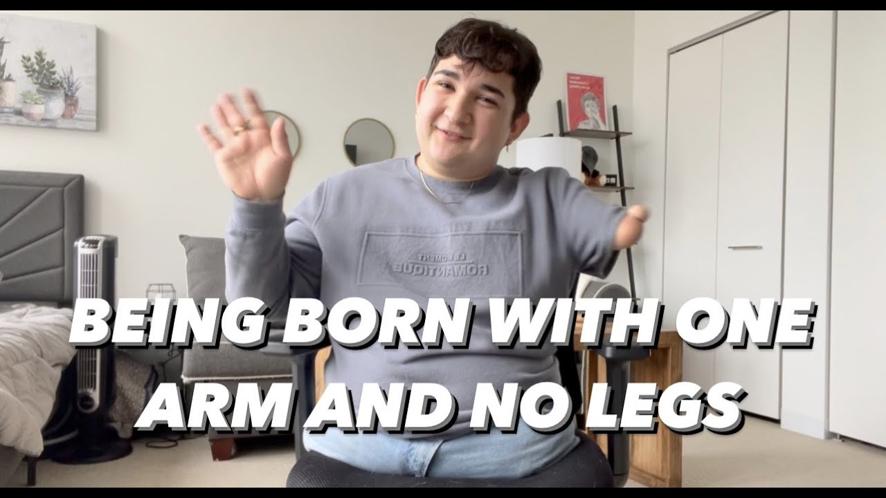 One Limb Tim: My Story! (Well.. part of it)