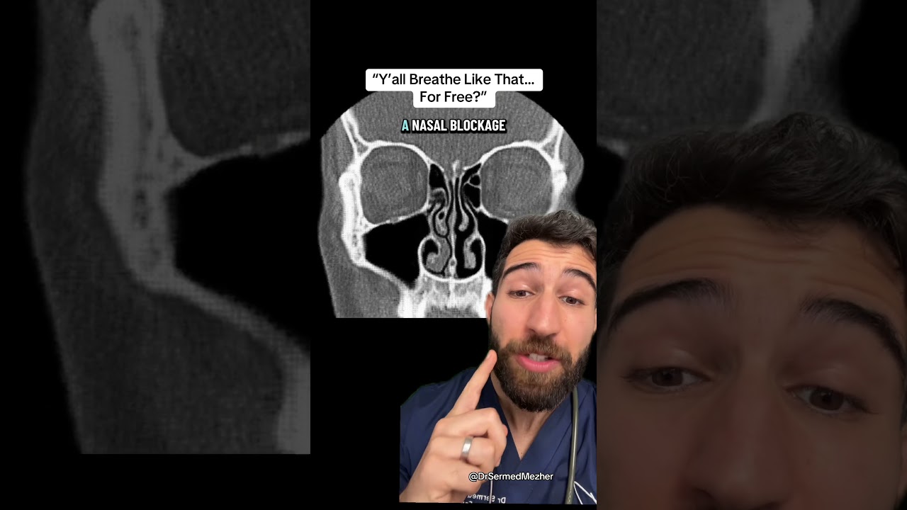 4 Signs You Have a Deviated Nasal Septum