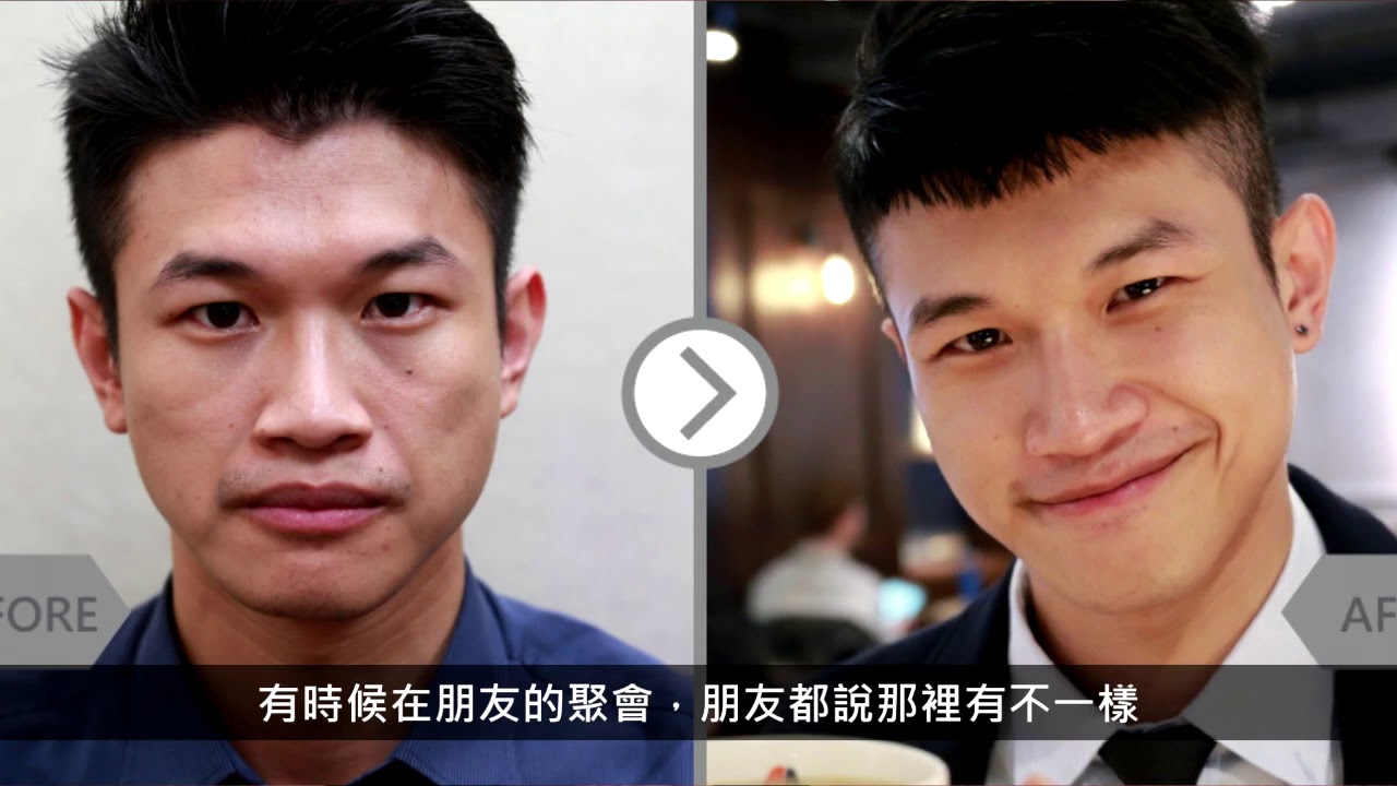 iSkin 盧靜怡皮膚專科診所【玻尿酸】 陽光型男空少 就是要帥得不著痕跡 willian