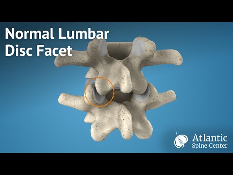 Flex Animal osteocondrosi Sublussazione delle articolazioni vertebrali