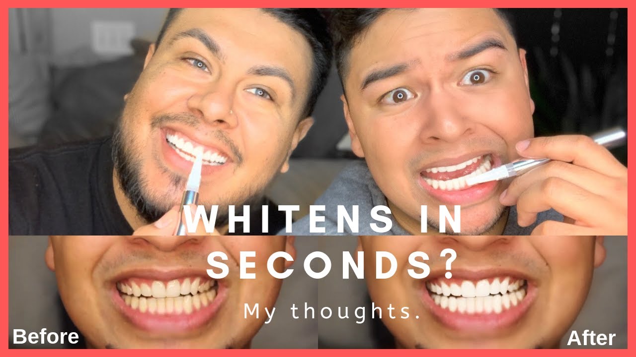 Watch video Teeth Whitening Pen that works in Seconds | Review Now Teeth Whitening Pen that works in Seconds | Review