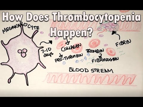 How does thrombocytopenia happen | Low platelets and the COVID vaccine