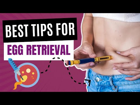 How to prepare for EGG RETRIEVAL - Pro Tips for How to Have the Best Egg Retrieval Experience