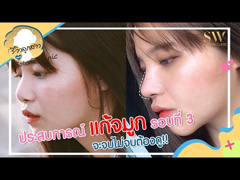 โบท็อก ปีกจมูก