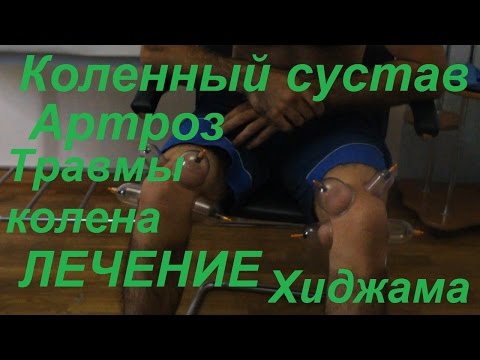 Уколы в коленный сустав дипроспан отзывы Сильная боль в спине 40 неделя беременности